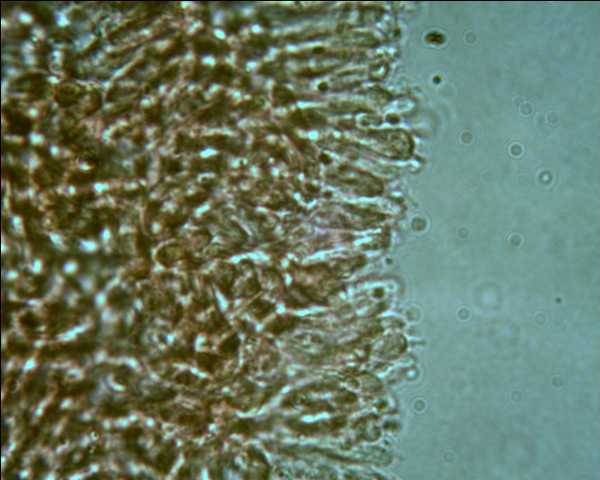 Phlebia tremellosa?